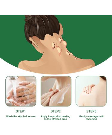  limination Des Lipomes 30g limination Douce Des Lipomes Pommade Apaisante pour la Peau Pour Visage Corps Articulations Jambe Bras Dos Routine Quotidienne Nuit Voyage Massage - Buy Online on GoSupps.com