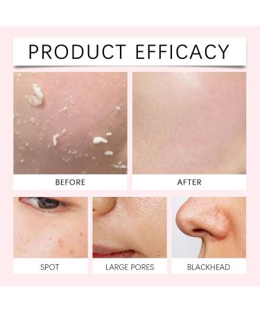 Brightening Bikini Scrub For Body Care Intimate Exfoliating Body Scrub For Dark Spots Ingrown Hair Treatment For Bikini Area Bump Eraser Bikini Area Exfoliator for Women 150 g (3pc) - Buy Online on GoSupps.com