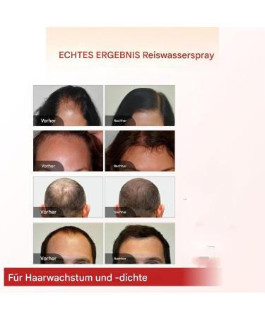  szaluyk hair growth spray scalp regrowth treatment moisturizing care conditioner conditioner oil to support follicles daily scalp refresh for a scalp - Buy Online on GoSupps.com