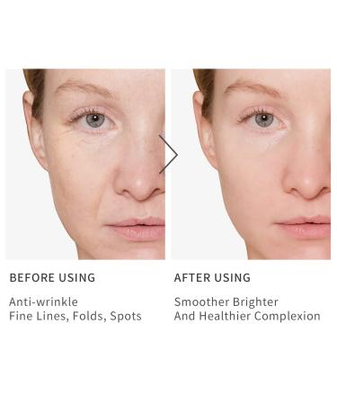 Vitamin C Serum for Face - Anti-Aging with Hyaluronic Acid Vitamin E & Retinol | Dark Spot Remover & Wrinkle Reducer for Women - Buy Online on GoSupps.com