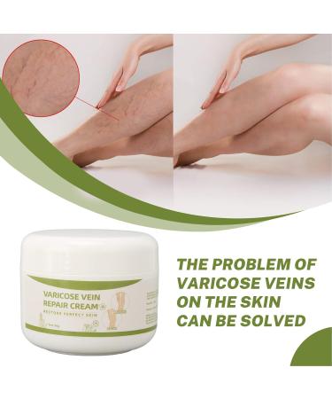 Cream for Varicose Veins for Legs 50G Natural Oils Formula Phlebitis Relief Treatment Soothing Cream for Anti Varicose - Buy Online on GoSupps.com