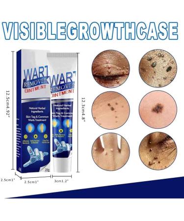 Wartsoff Instant Blemish Cream Wart Remover Cream Safe Natural Extract Wart Remover Ointment Warts Remover Wart Removal Ointment Against Warts - Buy Online on GoSupps.com