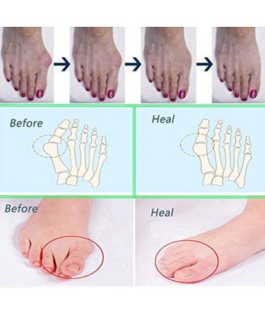 Toe Separator & Spreader for Men & Women | Rubber Toe Spreader for Sports Yoga & Pain Relief - Buy Online on GoSupps.com