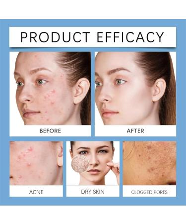 Anti-Acne Skin Care Set for Men Anti-Redness Moisturizes Acne Prone Skin Anti-Acne Skin Care Set Filled with Hand-Picked Organic Botanicals - Buy Online on GoSupps.com