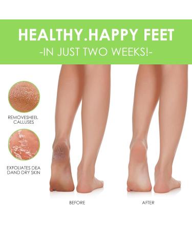 Exfoliating Foot Mask - 2 Pairs of Cornea Socks for Men & Women | Effective Foot Care for Tender Feet | Vera Green - Buy Online on GoSupps.com
