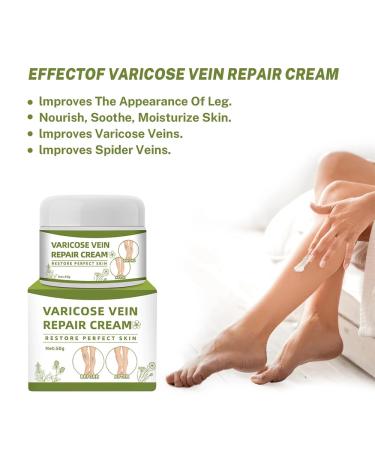 Varicose Veins Cream - Repair Spider Veins & Leg Treatment (50g) | Effective Relief for Healthy Legs - Buy Online on GoSupps.com