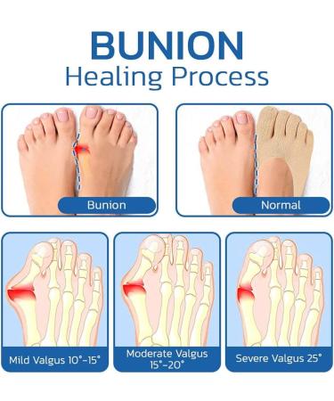 Projoint Anti-Bunions Health Socks - Compression Socks for Swelling Relief (8 Pairs) - Buy Online on GoSupps.com