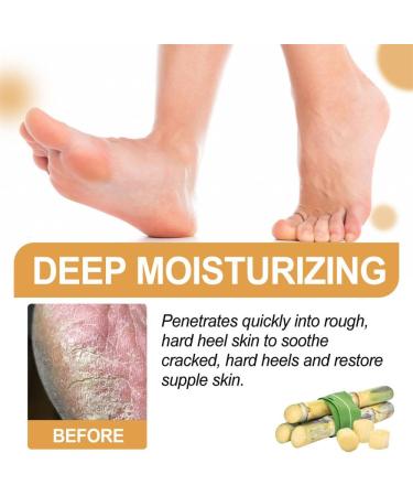 Laluerck 30 ml pedicure peeling for dead skin for cracked rough heels and dry toe skin Standard - Buy Online on GoSupps.com