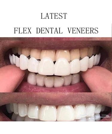 Brigtviee 2 Pair Instant Veneers - Fake Teeth Veneers for Men & Women | Snap-On Temporary Prostheses for Perfect Smile | International Shipping Available - Buy Online on GoSupps.com