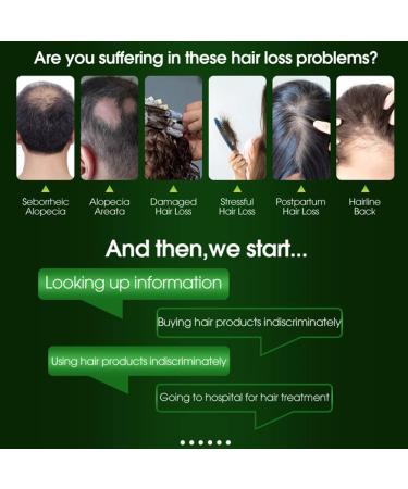 Hair Growth Shampoo Anti-Hair Loss Shampoo Shampoo for Thinning Hair and Hair Loss Strong Natural Organic Ingredients Repairs Damaged Scalp - Buy Online on GoSupps.com