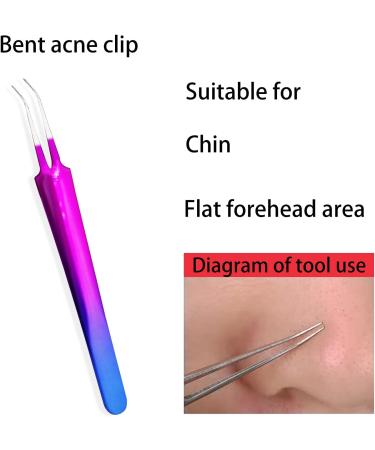 9PCS Blackhead Remover Tool Kit Professional Pimple Popper Tool -Treatment for Pimples Blackheads Blemish Zit Removing Forehead and Nose(Colorful) - Buy Online on GoSupps.com