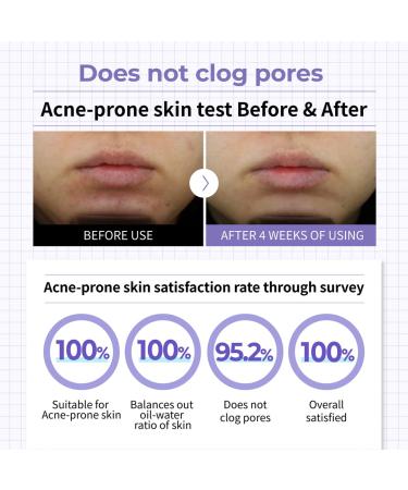 Numbuzin No.1 Purple Complex Moisture Balancing Cream 3.38 fl oz | Lightweight Facial Moisturizer for Acne-Prone Skin | Korean Skin Care - Buy Online on GoSupps.com