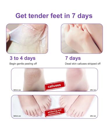 NewFoot Foot Peel Mask 2 Pack - Exfoliating Natural Masks for Dry Cracked Feet - Moisturizing and Softening Callus Treatment - Smooth Baby Feet - Purple - Buy Online on GoSupps.com