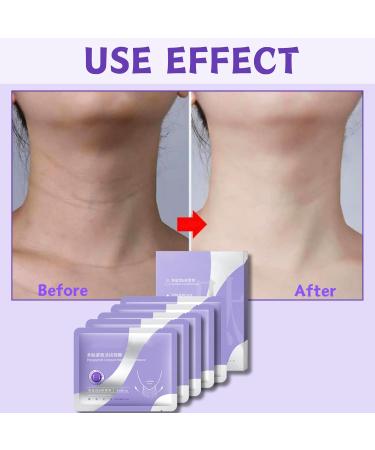 Squalane Neck Mask Neck Wrinkle Patches Dark Neck Remover Neck Firming Anti Aging Neck Mask Anti Wrinkle Patches For Skin Anti Ageing Neck Wrinkle Patch For Neck Tightening And tightening - Buy Online on GoSupps.com