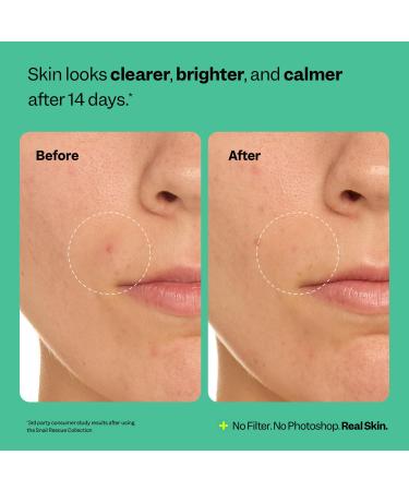 Peach Slices - Snail Rescue Purifying Cleanser (4.05 oz) - Snail Mucin Concentrate - Cleanse & Refresh Skin - Pine Bark Hyaluronic Acid & Cica - Vegan & Cruelty Free - Korean Skin Care & Beauty - Buy Online on GoSupps.com