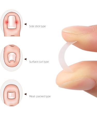 Ingrown Toenail Corrector Strips 40pcs Easy to Use & Remove Discomfort Made of Excellent Resin Material - Buy Online on GoSupps.com