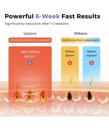 Ualans Wireless IPL Hair Removal Device | Pain-Free Quick Results in 6 Weeks | Sapphire-Freezing Cooling | Portable for Body & Face | Perfect Gift for Women - Buy Online on GoSupps.com
