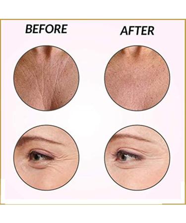 Anti-Wrinkle Reusable Silicone Patches Wrinkles Patches Chest Wrinkle Pads Facial Wrinkle Remover Strips Wrinkle Patches for Face Neck and Chest (11 Pcs) - Buy Online on GoSupps.com