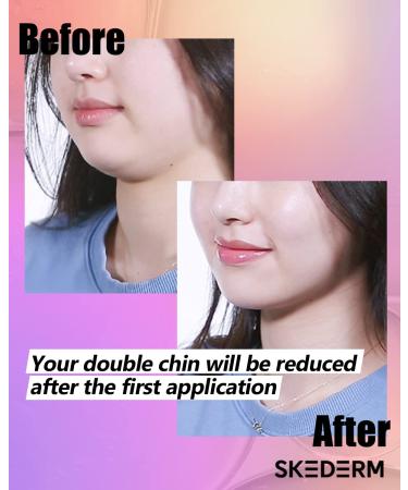 SKEDERM Lifting Patch Peptide | V Line Face Mask for Double Chin Reduction - Buy Online on GoSupps.com