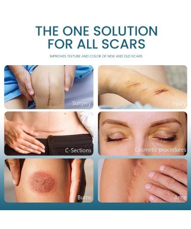 Advanced Scar Cream Gel - Effective Scar Removal for Surgical Scars Burns Acne C-Sections & More | Suitable for All Skin Types - 1.06 Oz - Buy Online on GoSupps.com