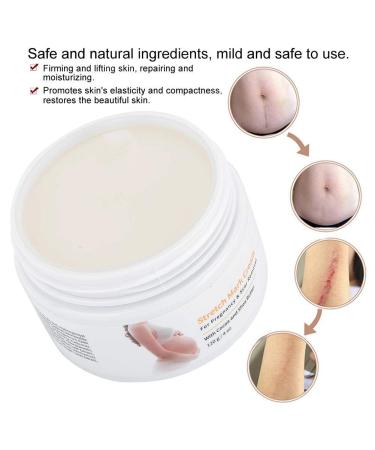 Stretch Stripes Cream 120g | Remove Stretch Marks Pregnancy Scars & Acne | Maternity Repair Treatment - Buy Online on GoSupps.com