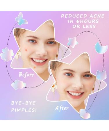 Acne Patches with Natural Green Algae & Tea Tree Oil | Hydrocolloid Treatment for Zits Pimples & Blemishes - Fast International Shipping - Buy Online on GoSupps.com