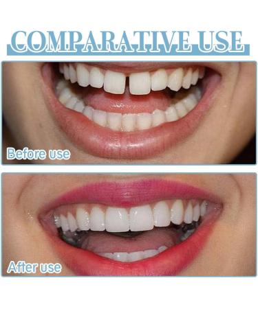 HABNI 4 pairs perfect smile prosthesis plate dentures cosmetic veneer teeth temporary tooth replacement veneer veneer dental vase for upper jaw and lower jaw - Buy Online on GoSupps.com