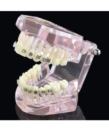 Samnuerly Dental Orthodontic Brackets Model - Ideal for Research & Treatment in Dentistry | International Shipping - Buy Online on GoSupps.com