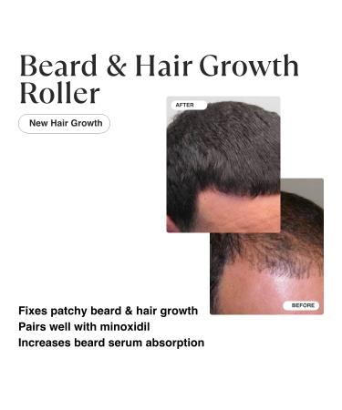 MATKAS Derma Roller + Cleaner Spray Kit - Microneedle Roller for Face, Hair, Scalp, Beard Growth - Dermaroller Microneedling Roller for Hair Regrowth and Skin Renewal - Buy Online on GoSupps.com