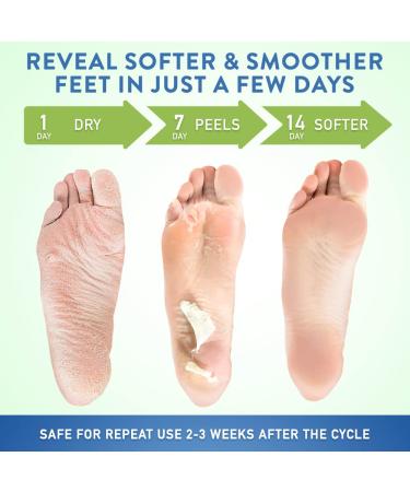 Wild Beauty Foot Peel Mask (3 Pairs) - Moisturizing Exfoliator for Dry, Cracked Feet - Buy Online on GoSupps.com