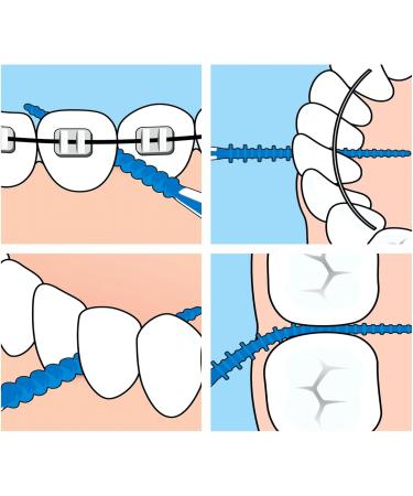 200 Interdental Brushes & Silicone Toothpicks | Dental Cleaning Tools for Teeth | Blue Interdental Brush Set - Buy Online on GoSupps.com