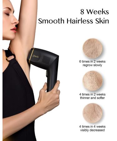 IPL Hair Removal for Women - Permanent Hair Remover with 2 Precision Attachments - Unlimited Flashes - Facial Bikini Line Armpits - Corded Function - Gold - Buy Online on GoSupps.com