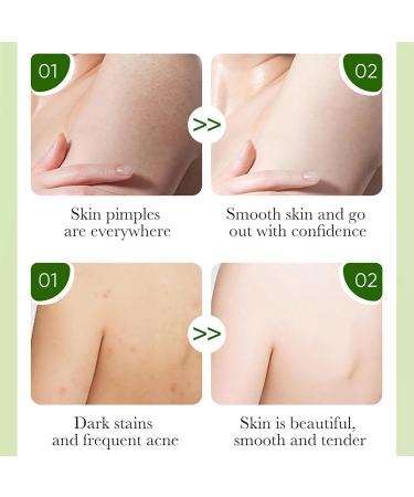 Bamboo Soap Bar - Charcoal Soap - Bamboo Charcoal Soap - Hand Body Face Wash Soap Bar - Remove Mite Oil Control Clean Pore Dirt - Moisturize Hydrate Smooth Tender Plump - Improve Dullness Elasticity - Buy Online on GoSupps.com