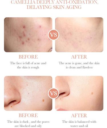 Camellia Skin Care Sets for Teenage Girls - 3PCS Pamper Gift Sets with Cleanser, Serum, and Cream for Moisture and Elasticity - Buy Online on GoSupps.com