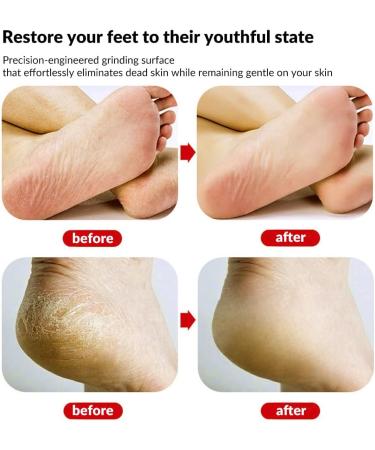 Premium Glass Foot File | Callus Remover with Etching Technology | Portable Foot Scraper for Cracked Heels | Shining Blue - Ideal for Wet & Dry Feet - Buy Online on GoSupps.com