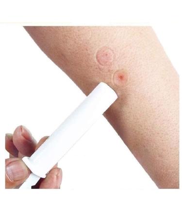 Finever 2PK Mosquito Bee Sting Bug Bite Kit Suction Tool Safety First Aid Supplies Tool Natural Sting First Aid for Hiking Backpacking Camping - Buy Online on GoSupps.com