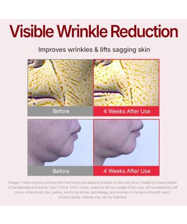 CENTELLIAN 24 Madeca Cream Time Reverse & Matcha Toning Peeling Gel Bundle (1.69 + 5.07 fl oz) Hydrating Skin Care Set for Firming Wrinkle Reduction Exfoliation & Skin Balance Centella Asiatica - Buy Online on GoSupps.com