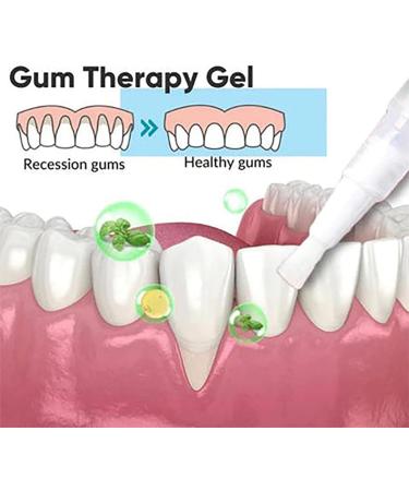HEXEH Taileden Gum Therapy Gel - Gum Therapy Gel for Recessed Gums Taileden Gum Care Gel Gum Shield Therapy Gel Taileden Gum Gel Teeth Whitening Essence Pen (2pcs) - Buy Online on GoSupps.com