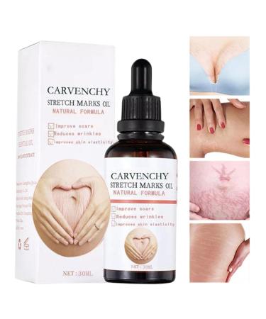 Oil for Stretch Marks Pregnancy Massage essential oil for stretch marks Body oil moisturizes and stimulates natural elasticity of skin pregnancy and beyond Bexdug