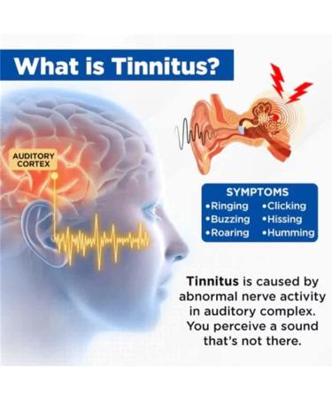 2023 Newest MRIMED Luhaka Acupeace Tinnitus Relief Device Biancat Auricalm Tinnitus Relief Device Acupeace Anti Tinnitus Relief Ear Clip (1) - Buy Online on GoSupps.com