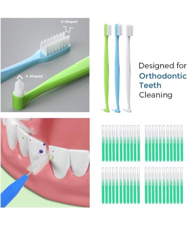 NAGY Braces Cleaning Kit - Complete Orthodontic Care with Toothbrush Interdental Brushes Dental Floss & Wax | Essential Braces Accessories for Optimal Oral Hygiene - Buy Online on GoSupps.com