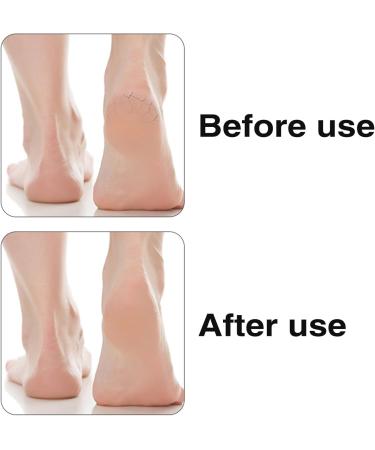 Premium Bimsstein Bar & Pumice Stone Foot Scrubber - High-Quality Foot Care for Cracked Heels & Dead Skin Removal | International Shipping - Buy Online on GoSupps.com