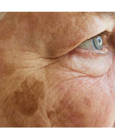 Triderm AK 30 Capsules Advanced Skin Health Capsules - Buy Online on GoSupps.com