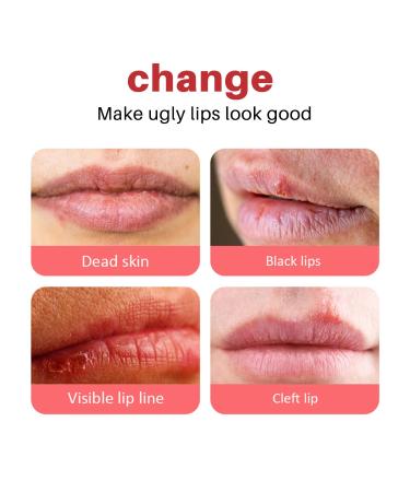 Dark Lips Brightening Lip Balm - Intensive Moisturizing Nourishing Repair Stick Natural Formula Long-Lasting Hydration 0.17 Oz (Pack of 2) Non-Irritating for Dry Chapped Lips - Buy Online on GoSupps.com