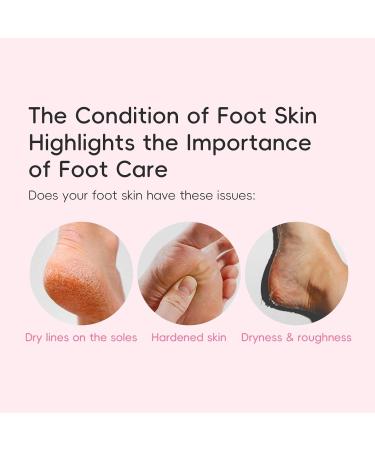 2 Pack Cherry Blossom Moisturizing Foot Cream for Dry Cracked Skin with Aloe Vera Nourishing Rough Feet and Hands Non-Greasy Fast Absorbing for All - Buy Online on GoSupps.com