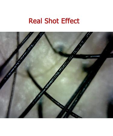 Skin Follicle Detector Portable Detachable WiFi Skin Diagnosis Hair Analyzer with APP Control and Adjustable LED Lights Support Manual Focus and Picture Video for Scalp Follicles - Buy Online on GoSupps.com