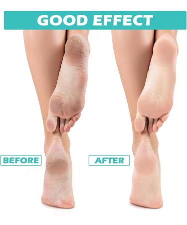 Buy Tarpop Aloe Socks - Moisturizing Spa Socks for Dry Cracked Feet | Infused Gel Fuzzy Socks Gift for Christmas | Softening Lotion Socks for Men & Women - Buy Online on GoSupps.com