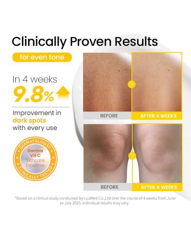 #OOTD Vitamin C Body Wash, 750ml (25.36 fl oz.) Gentle Daily Cleanser with Niacinamide for Dull & Sensitive Skin - Buy Online on GoSupps.com