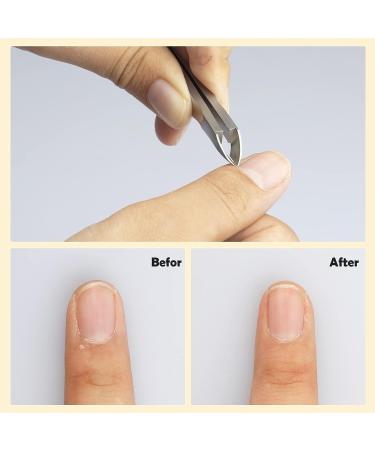 ONNPNN 2-Piece Stainless Steel Cuticle Cutter Set - Professional Cuticle Remover Tools for Manicure & Pedicure - Buy Online on GoSupps.com