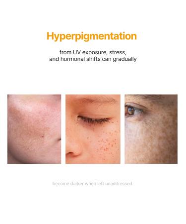 LABIORA CARE CREAM with TXA NIACINAMIDE for Uneven Skin Tone, Brightening & Radiance Support with Tranexamic Acid 6%, Niacinamide 4%, Glutathione & Arbutin, 0.67 fl oz - Buy Online on GoSupps.com